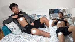 Mesajlaştığı Kızın Eski Sevgilisi Tarafından Saldırıya Uğradı: 15 Yaşındaki &Ccedil;ocuk Dehşeti Yaşadı