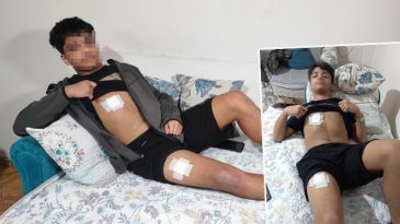 Mesajlaştığı Kızın Eski Sevgilisi Tarafından Saldırıya Uğradı: 15 Yaşındaki &Ccedil;ocuk Dehşeti Yaşadı