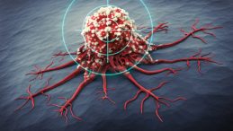 Mide Kanseri: Sessiz Katil Hakkında Bilmeniz Gerekenler