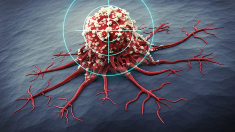 Mide Kanseri: Sessiz Katil Hakkında Bilmeniz Gerekenler