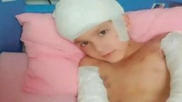 Sokak k&ouml;peği saldırısı davasında emsal karar: 5 milyon lira tazminat