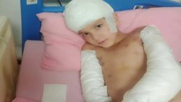 SON DAKİKA&hellip; Sokak k&ouml;peklerinin saldırısında ağır yaralanan &ccedil;ocuk i&ccedil;in emsal karar: Ailesine rekor tazminat…