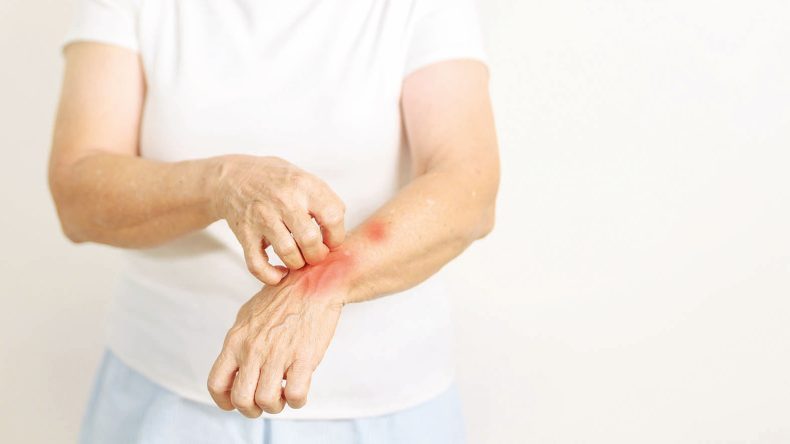 Türkiye’nin Alerji Haritası Çıkarıldı