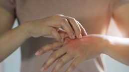 Uzmanlardan Kış Egzaması Uyarısı: Bu Alışkanlıktan Vazge&ccedil;in