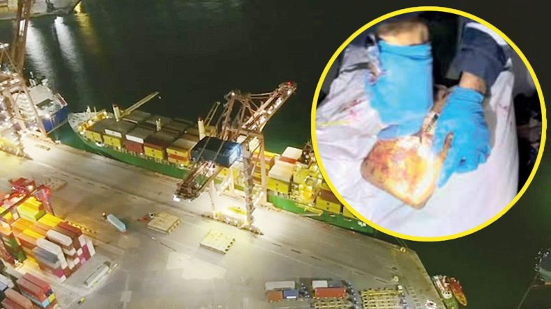 Yerfıstığı Konteynerinde Kokain Bulundu