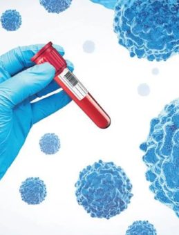 Akciğer Kanserinde Erken Teşhis Umudu