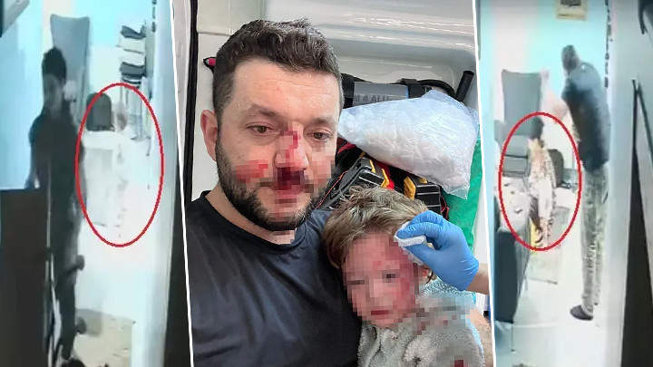 Baba ile 14 Aylık Kızının Darbe Olayında İddianame Hazırlandı! &Ccedil;ocuk Scooter'ı 'Silah' Olarak Nitelendirildi… İşte Verilen Ceza Talebi