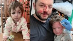 Baba ve 14 Aylık Kızına Scooter Saldırısı: Jet Hızında İddianame!