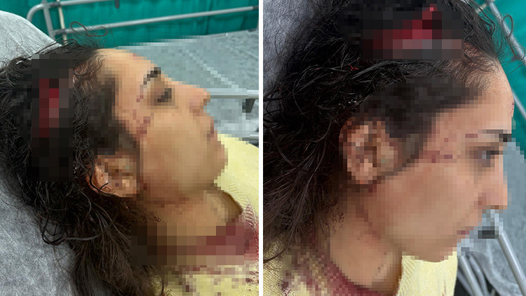 Bakkala Giden Gen&ccedil; Kadına Sokak K&ouml;pekleri Saldırdı