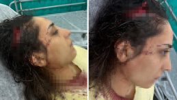 Bakkala Giden Gen&ccedil; Kadına Sokak K&ouml;pekleri Saldırdı