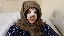 Gaziantep'te Boşanma Aşamasındaki Eşine Şiddet Uyguladı: Kaldırım Taşıyla Darp Ederek…