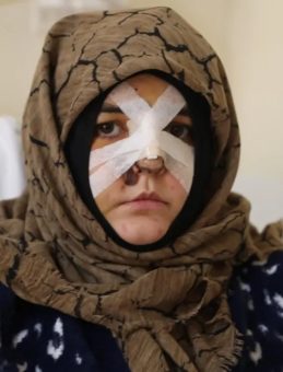 Gaziantep'te Boşanma Aşamasındaki Eşine Şiddet Uyguladı: Kaldırım Taşıyla Darp Ederek…