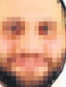 G&ouml;ğ&uuml;s Estetiği K&acirc;busa D&ouml;n&uuml;şt&uuml;