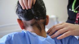 Hatay'da 14 Yaşındaki &Ccedil;ocuğun Karnından 3 Kilogramlık Sa&ccedil; Yumağı &Ccedil;ıkarıldı