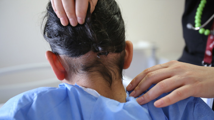 Hatay'da 14 Yaşındaki &Ccedil;ocuğun Karnından 3 Kilogramlık Sa&ccedil; Yumağı &Ccedil;ıkarıldı