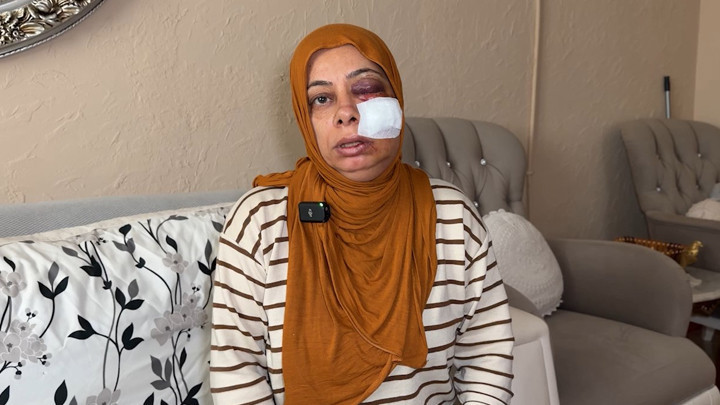 İskenderun'da elektrikli bisikleti ile kapağı kırık rögara düştü! 'Ölümden döndüm'