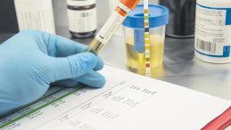 İşverenler Artık Uyuşturucu Testi İstiyor