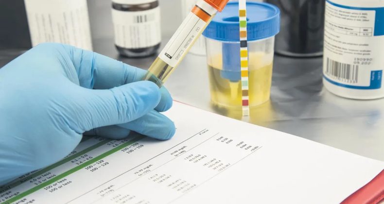 İşverenler Artık Uyuşturucu Testi İstiyor