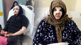 Kaldırım taşı ile saldırdı, Nazlı'nın kabusu oldu | '&Ccedil;ıkarsa yarım bıraktığı işi yapacak'