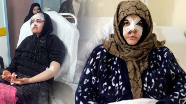 Kaldırım taşı ile saldırdı, Nazlı'nın kabusu oldu | '&Ccedil;ıkarsa yarım bıraktığı işi yapacak'