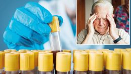 Kan Testleri ile Alzheimer'a Erken Teşhis İmkanları