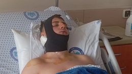 Kavga Ettikleri &Ouml;ğrencinin Omuriliğini ve &Ccedil;enesini Kırdılar! Akran Zorbalığına Tutuklama Kararı