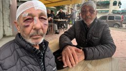 &Ouml;nce &ccedil;akmak istediler ardından sokak ortasında darbettiler