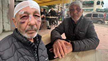 &Ouml;nce &ccedil;akmak istediler ardından sokak ortasında darbettiler