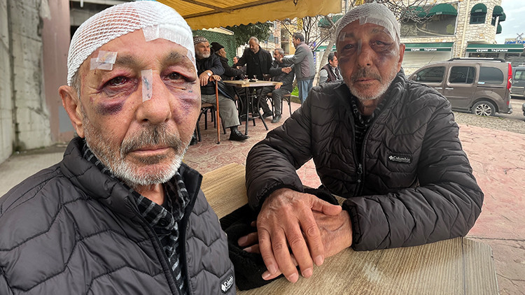 Önce çakmak istediler ardından sokak ortasında darbettiler