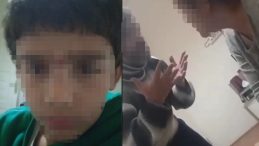 SON DAKİKA&hellip; Kayseri'de &uuml;vey babadan 9 yaşındaki &ccedil;ocuğa korkun&ccedil; şiddet!