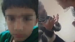 SON DAKİKA&hellip; Kayseri&rsquo;de &uuml;vey babası tarafından ağır yaralanmıştı! Annenin y&uuml;rek burkan ifadeleri: Oğlumun sırtı simsiyah!