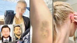 &Uuml;nl&uuml; Avukata Saldırı Ger&ccedil;ekleşti