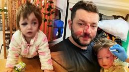 Yalova'da Baba ve 14 Aylık Bebeğinin Darbedildiği Olay İ&ccedil;in M&uuml;fettişler G&ouml;revlendirildi