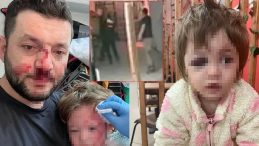 Yalova&rsquo;da 14 Aylık Bebek Darp Olayı: Sanıktan Şok A&ccedil;ıklama