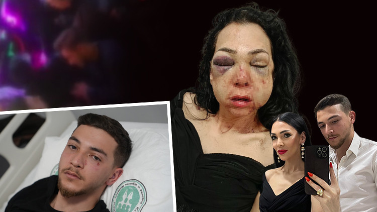 'Kadınlar var' diye uyarılınca dehşet saçtılar! Anne ve oğluna feci dayak…