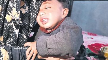 1 Yaşındaki Bebeğe İşkence