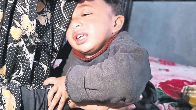 1 Yaşındaki Bebeğe İşkence