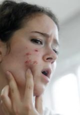 Anne s&ouml;z&uuml; m&uuml; bilimsel ger&ccedil;ek mi? &Ccedil;ikolatanın sivilce yaptığı iddiasına son nokta koyuldu!