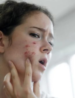 Anne s&ouml;z&uuml; m&uuml; bilimsel ger&ccedil;ek mi? &Ccedil;ikolatanın sivilce yaptığı iddiasına son nokta koyuldu!