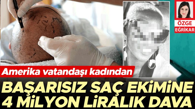 Başarısız Sa&ccedil; Ekimine 4 Milyon Liralık Dava
