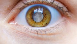 Doktorlar uyarıyor: Bu hastalık g&ouml;z sağlığınızı sessizce yok ediyor!