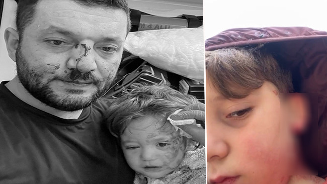 Kucağında 14 aylık bebeğiyle darbedilmişti: Bu kez de oğlu yaralandı! 'Tehditler alıyoruz, evimi satışa &ccedil;ıkardım'