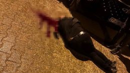 Şırnak'ta Sokak Ortasında Dehşet: Y&uuml;r&uuml;rken Başından Vuruldu!