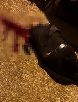 Şırnak'ta Sokak Ortasında Dehşet: Y&uuml;r&uuml;rken Başından Vuruldu!