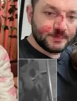 SON DAKİKA: Baba ve 14 aylık İkra bebek darbedildi: Türkiye'nin gündemini meşgul eden olayda yeni görüntüler gün yüzüne çıktı