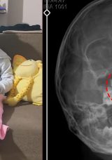 SON DAKİKA&hellip; Şiddetli kanama ve akıntı şikayetiyle gitti! Doktorlar bile şoka girdi: 5 yaşındaki Polen&rsquo;in burnundan bakın ne &ccedil;ıktı!