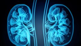 Taş Hastalığı B&ouml;brek Kaybına Neden Oluyor!