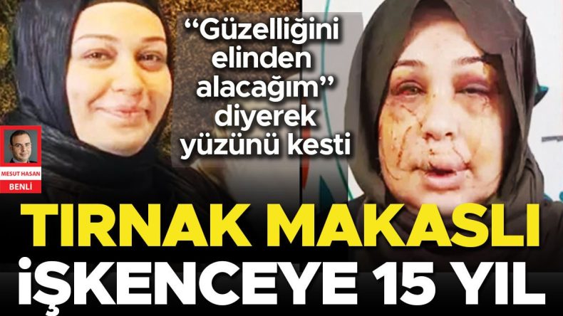 Tırnak makaslı işkenceye 15 yıl