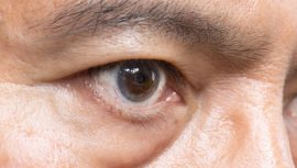 T&uuml;rkiye&rsquo;de 2 milyon kişi bu tehlikeyle yaşıyor! Sinsi sinsi ilerliyor, fark edildiğinde &ccedil;ok ge&ccedil; olabilir&hellip;