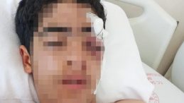 15 Yaşındaki &Ccedil;ocuğa Muhstalı Saldırı